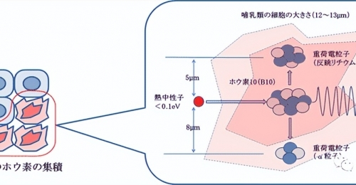 前锋：硼中子俘获治疗(BNCT)为肿瘤患者带来福音